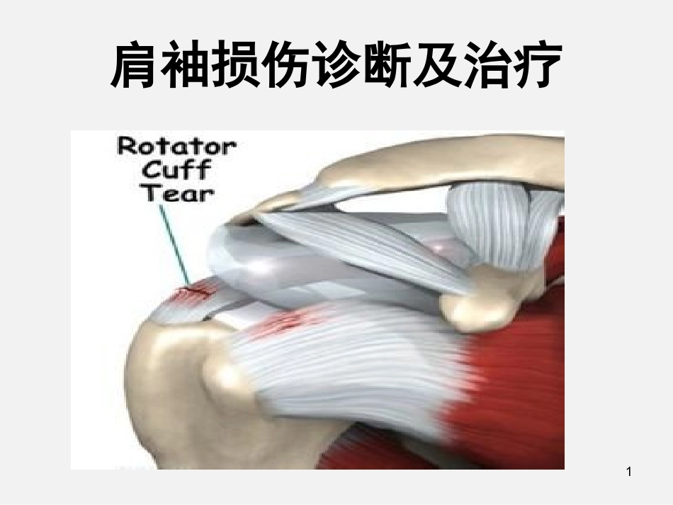 肩袖损伤诊断与治疗_第1页