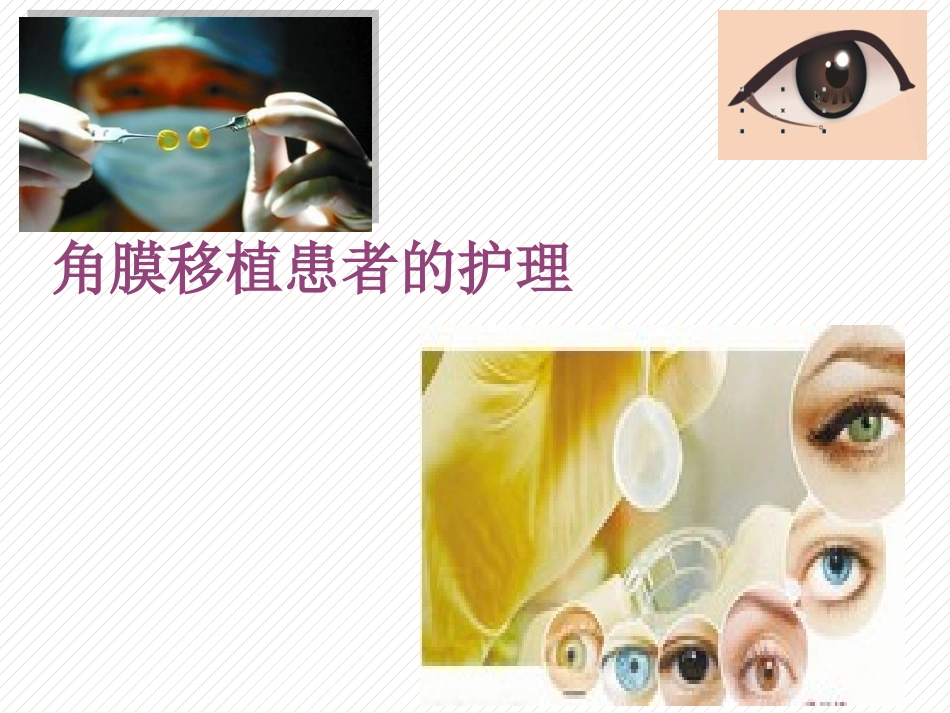 角膜移植的护理_第1页