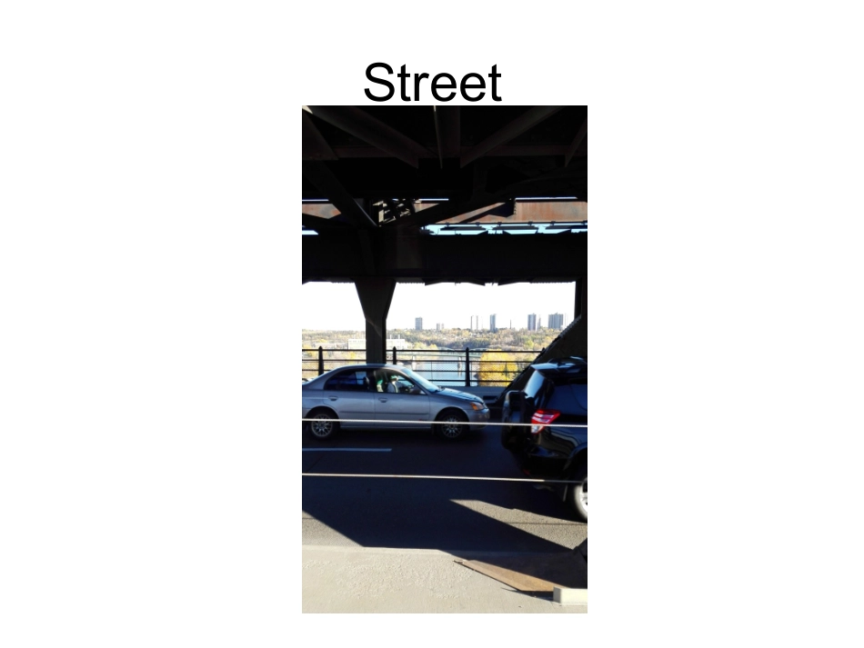 经皮主动脉瓣植入tavi_第3页