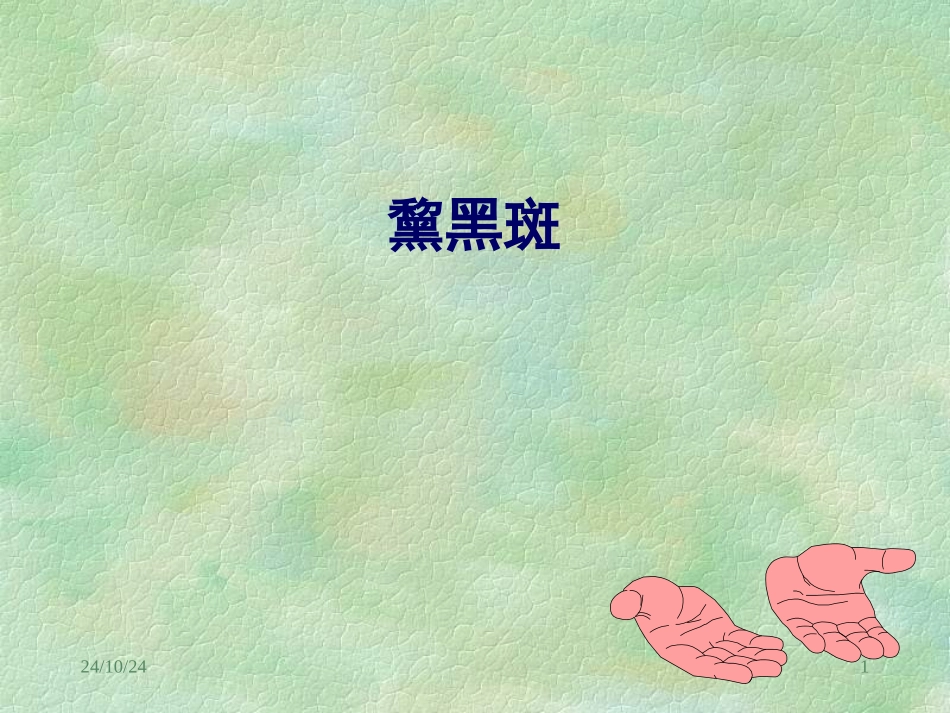 精品医学课件黧黑斑_第1页