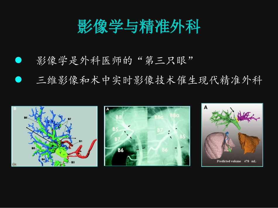 精准肝切除董家鸿_第2页