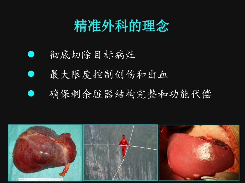 精准肝切除董家鸿_第3页