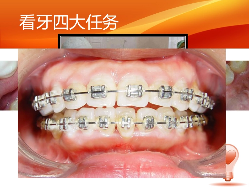 口腔健康知识宣教_第3页