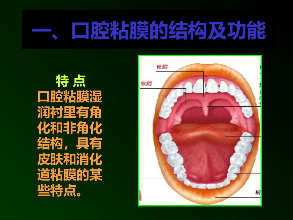 口腔溃疡诊疗和鉴别课件_第2页
