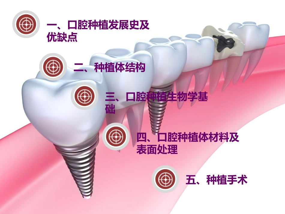 口腔种植义齿技术_第2页