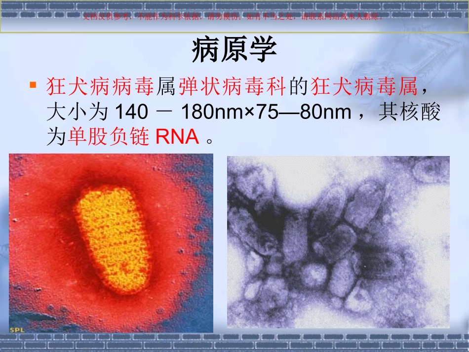 狂犬病病人的护理课件_第3页
