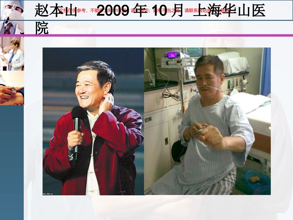 颅内动脉瘤的介入栓塞护理课件_第2页