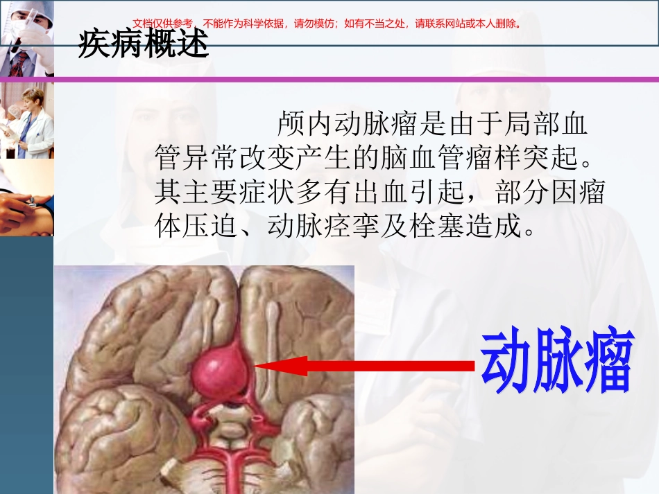 颅内动脉瘤的介入栓塞护理课件_第3页