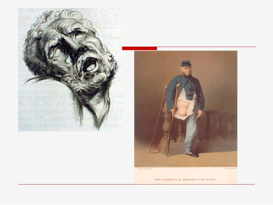 麻醉解剖学疼痛_第3页