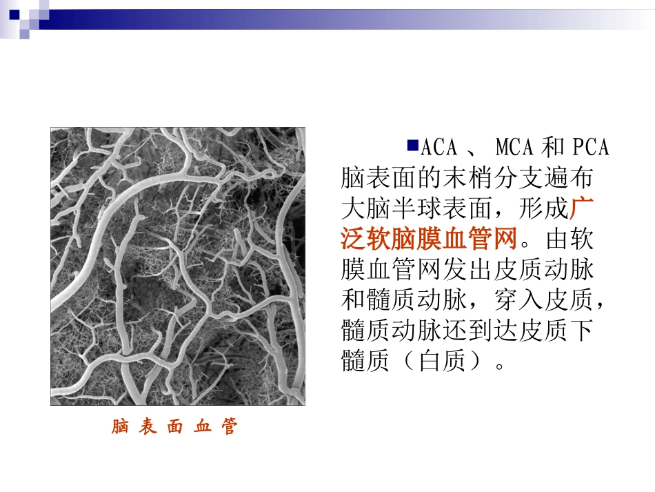 脑分水岭梗死_第3页