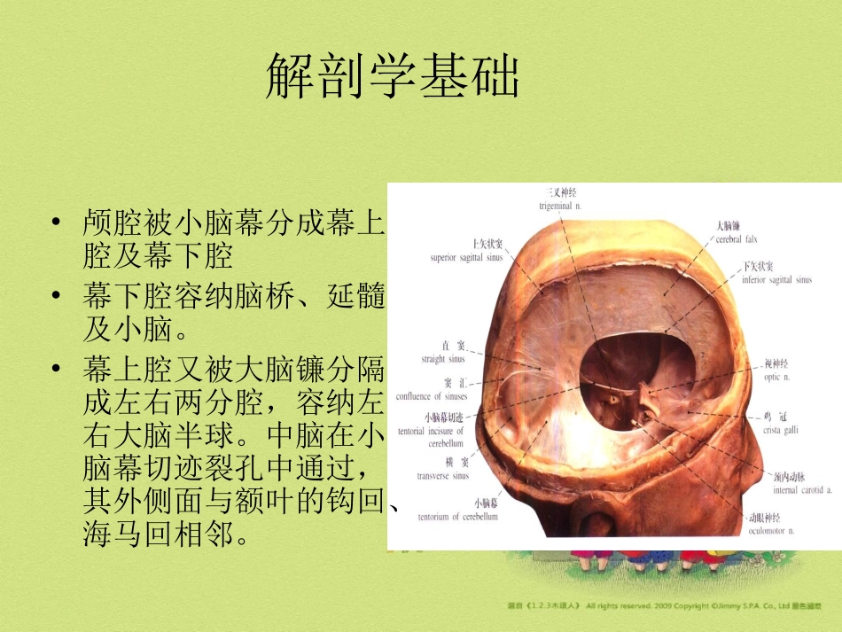 脑疝解剖学基础_第2页