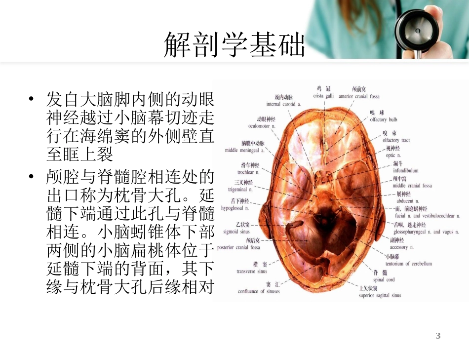 脑疝演示课件_第3页