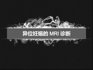 内耳畸形CT