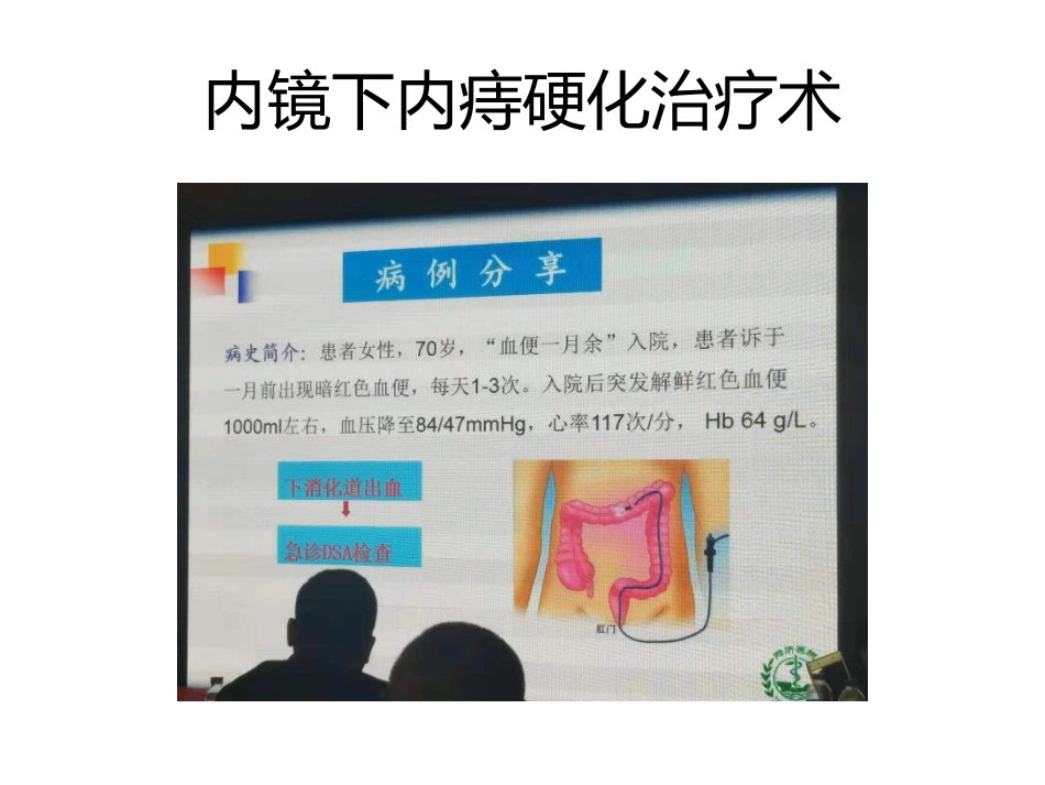 内痔硬化治疗术_第2页