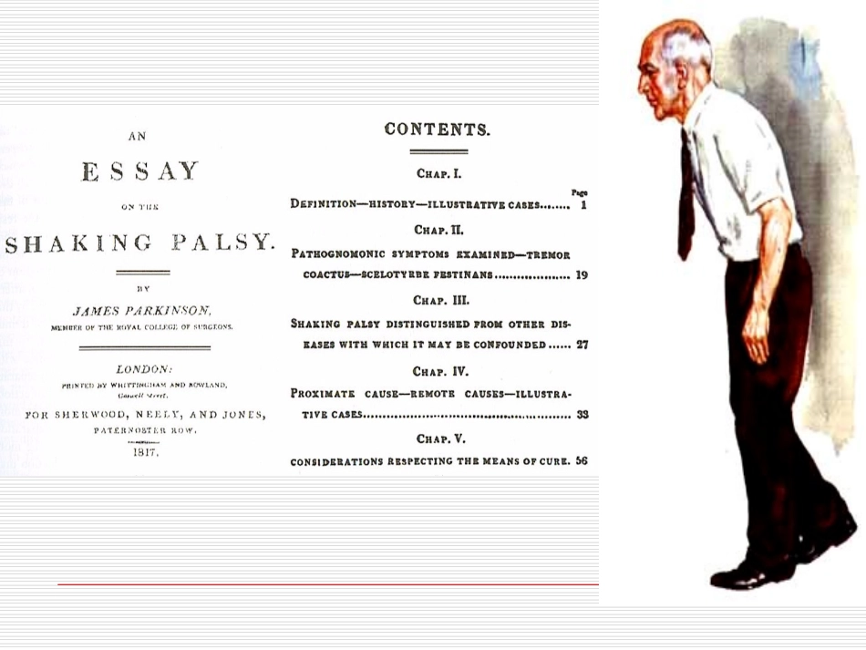 帕金森病诊治现状_第2页