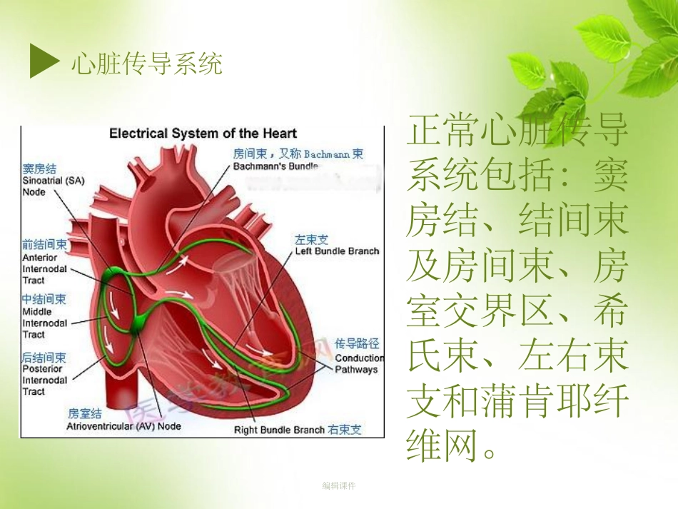 起搏器植入术后病人的护理_第3页