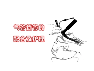 气管插管课件
