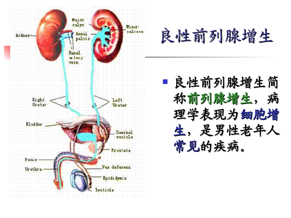 前列腺增生病人的护理_第2页