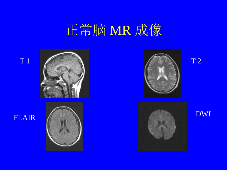浅谈磁共振诊断脑梗死_第3页