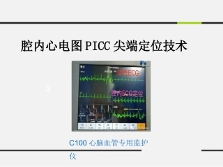 腔内心电图PICC尖端定位技术