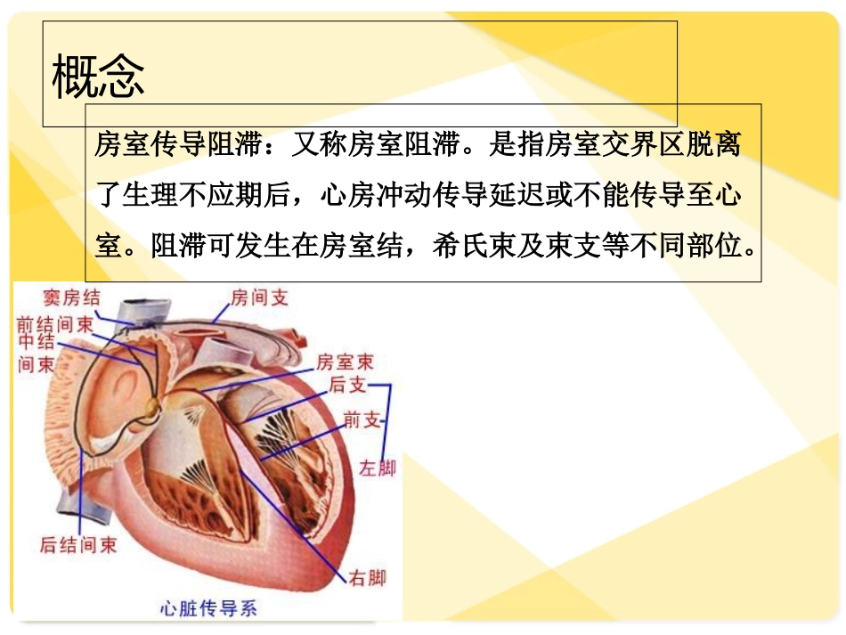 三度房室传导阻滞护理查房讲义_第3页