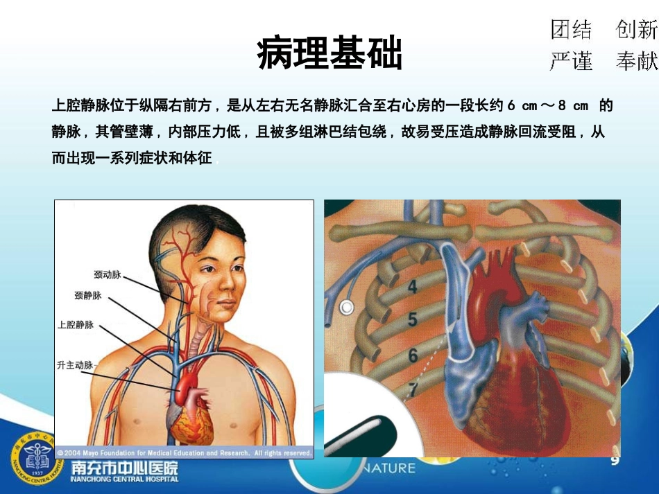 上腔静脉综合征护理查房资料_第3页