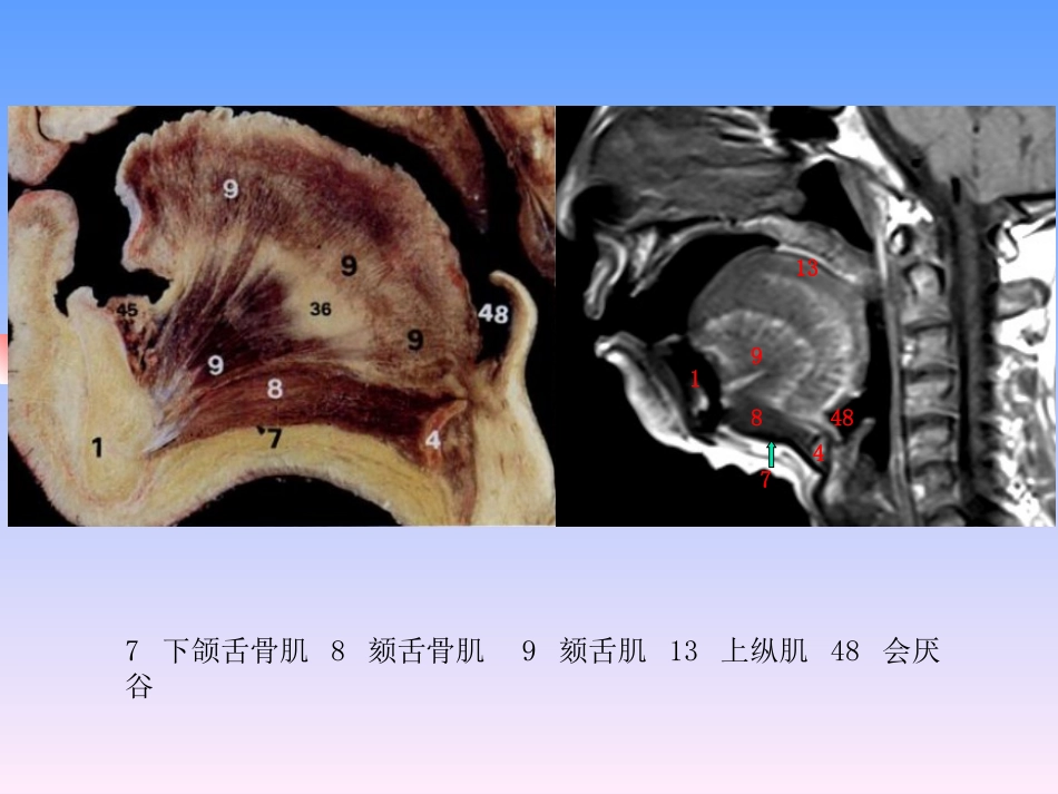 舌口底解剖和病变培训课件_第3页