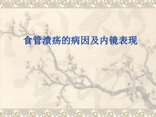 食管溃疡的病因及内镜表现