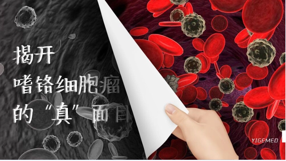 嗜铬细胞瘤患者护理_第3页