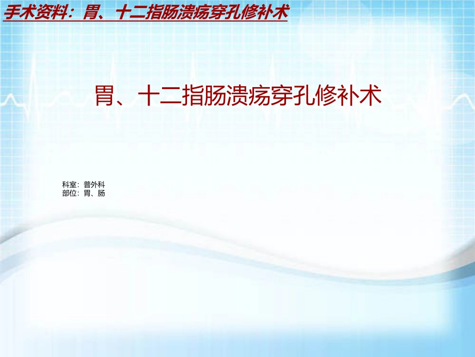 手术讲解模板胃十二指肠溃疡穿孔修补术_第2页