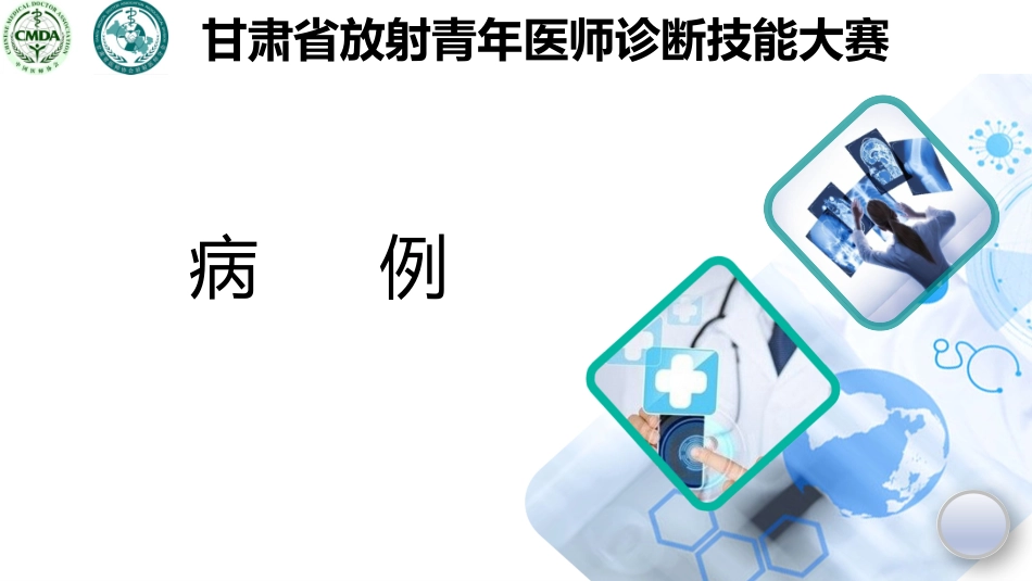 松果体生殖细胞瘤_第1页