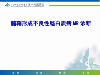 髓鞘形成不良性脑白质病