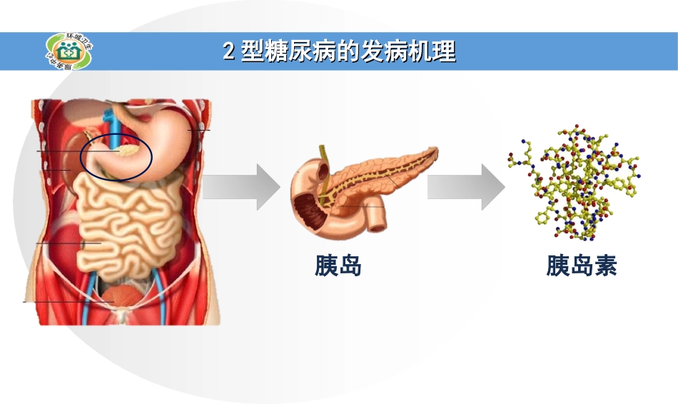 糖尿病的常用药物讲义_第3页