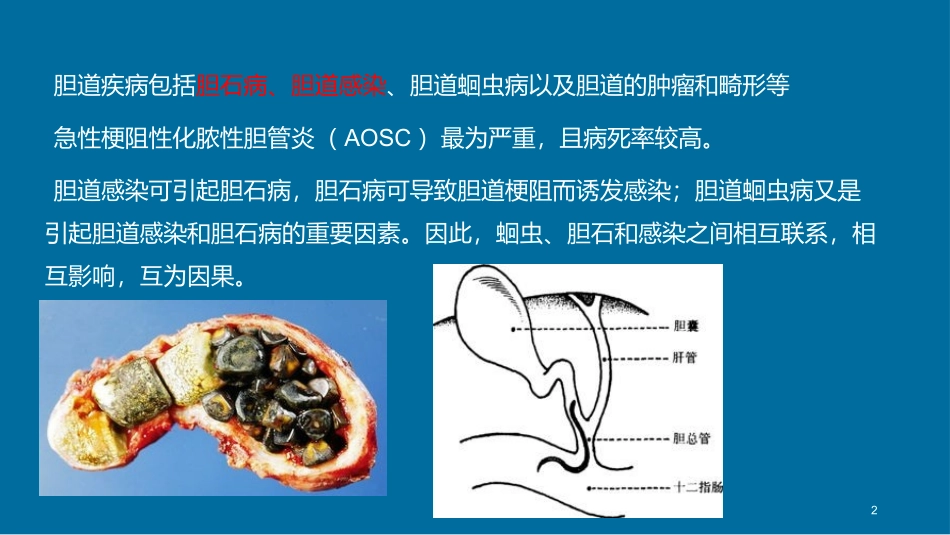 外科护理学胆道疾病_第2页