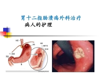 胃十二指肠溃疡外科治疗病人的护理