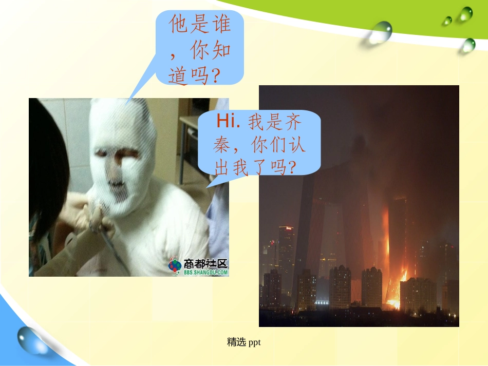 吸入性损伤的护理_第3页