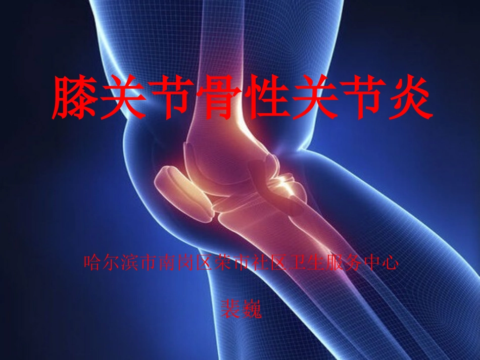 膝关节骨性关节炎_第1页