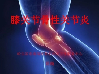 膝关节骨性关节炎