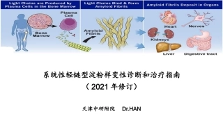 系统性轻链型淀粉样变性诊断和治疗指南修订