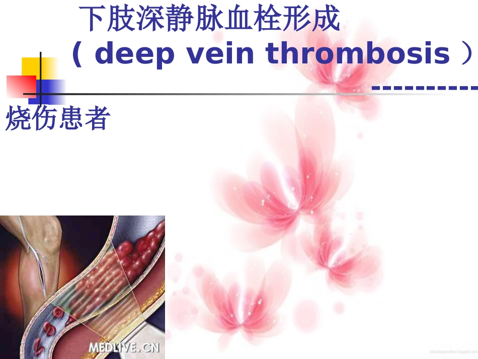 下肢深静脉血栓形成_第1页