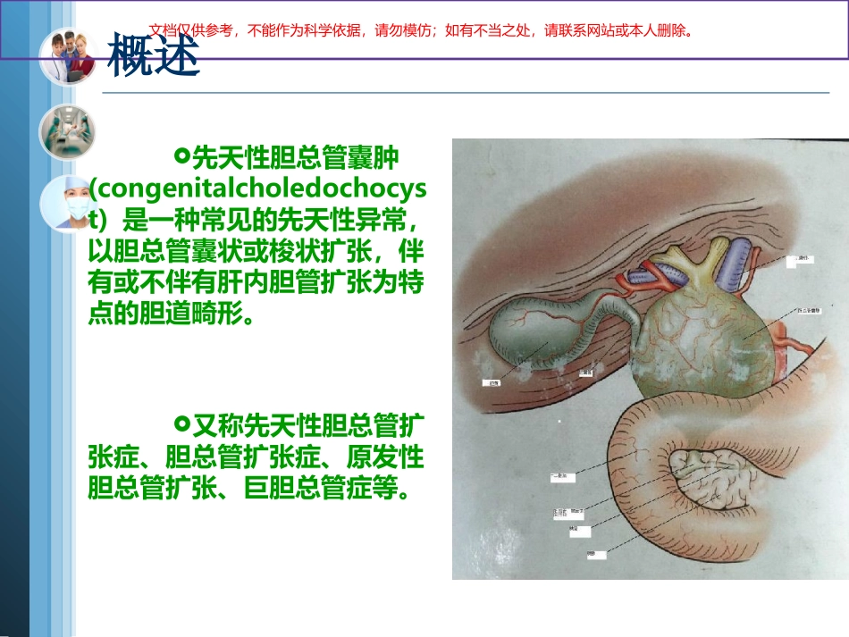 先天性胆总管囊肿和护理课件_第2页