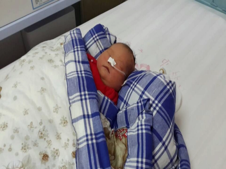 先天性肛门闭锁资料_第2页