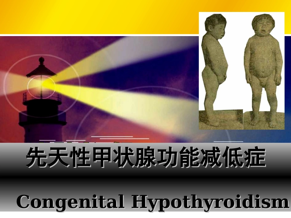 先天性甲状腺功能减退_第1页