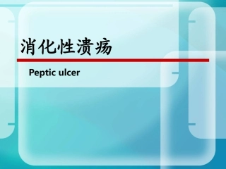 消化性溃疡课件