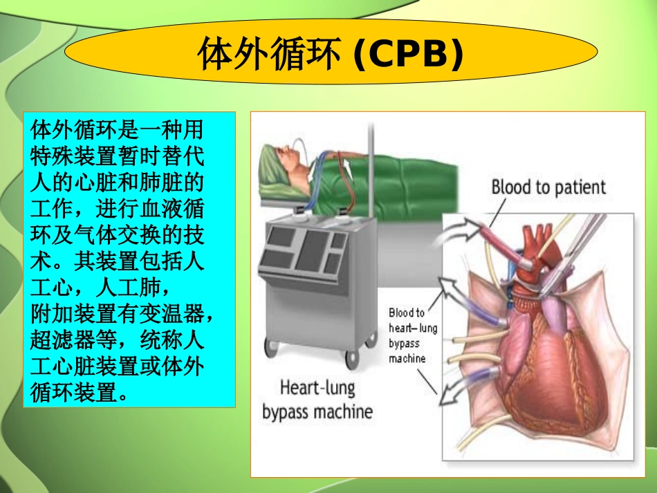 心脏外科术后监护讲义_第2页