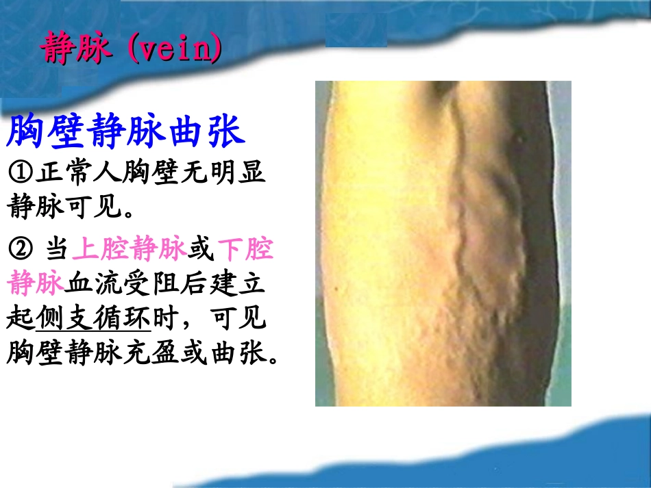 胸壁乳房查体详解_第3页