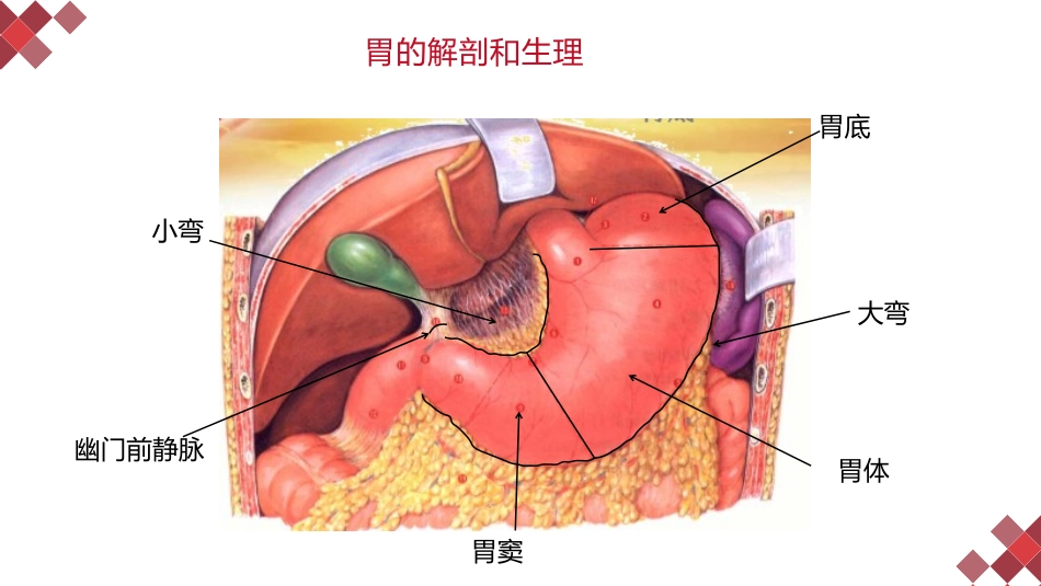 学习胃十二指肠溃疡病人护理_第3页