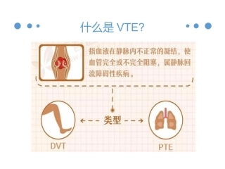 血栓的预防和管理