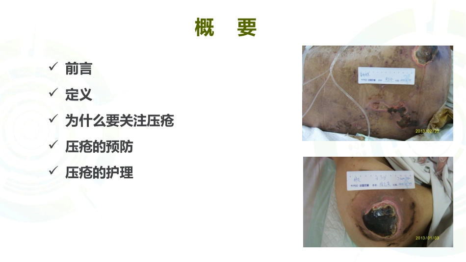 压力性损伤的预防与护理_第2页