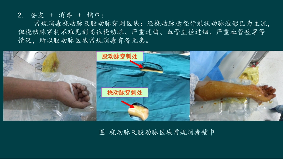 医学冠状动脉造影术基本操作培训课件_第3页